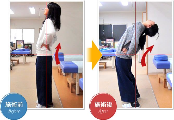 施術前→施術後