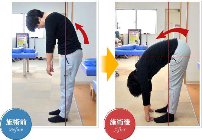 施術前→施術後